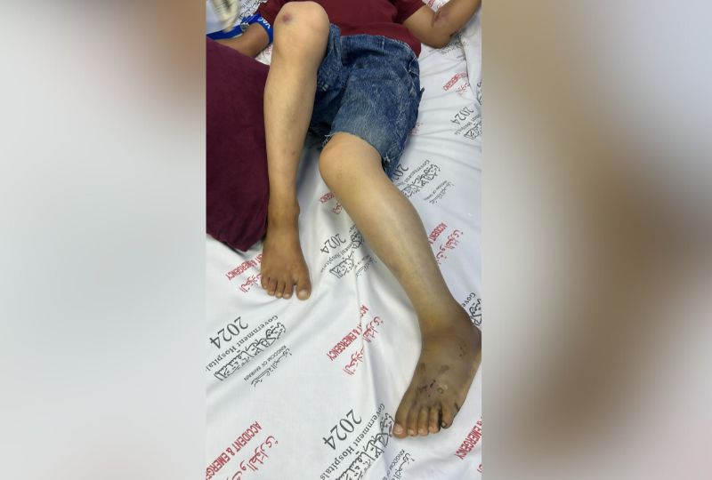 Treatment guidelines urged after rare case